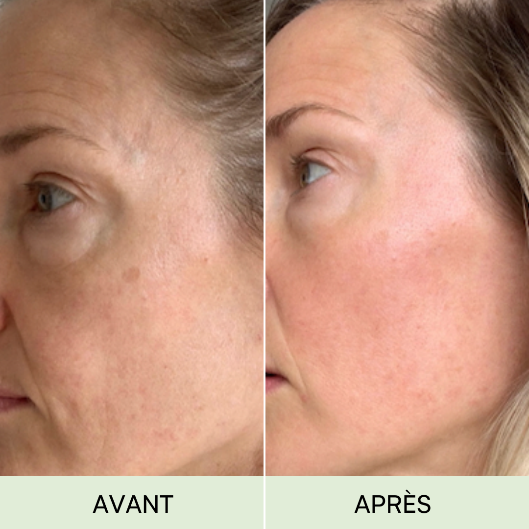 Routine peau parfaite + Coffret Cadeau