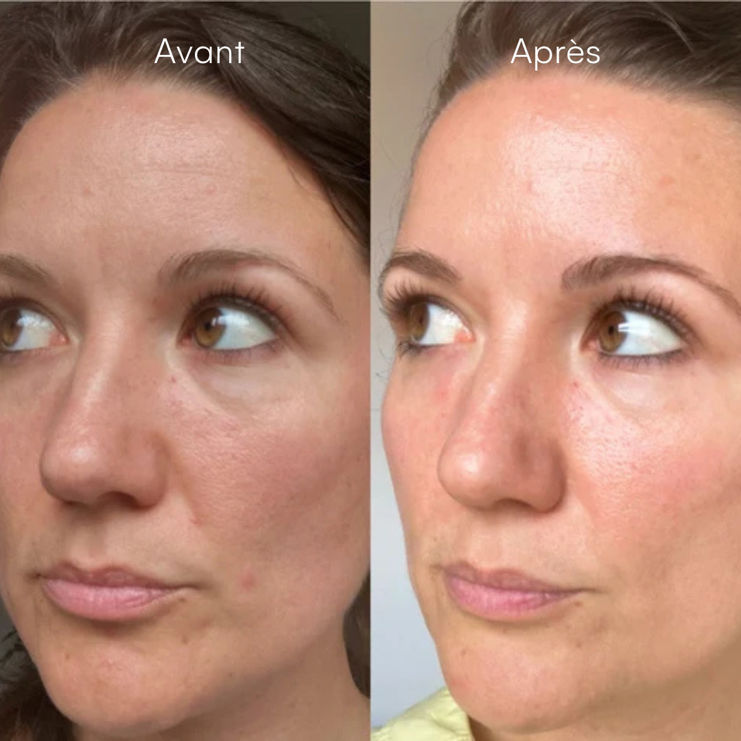 Routine Peau Neuve