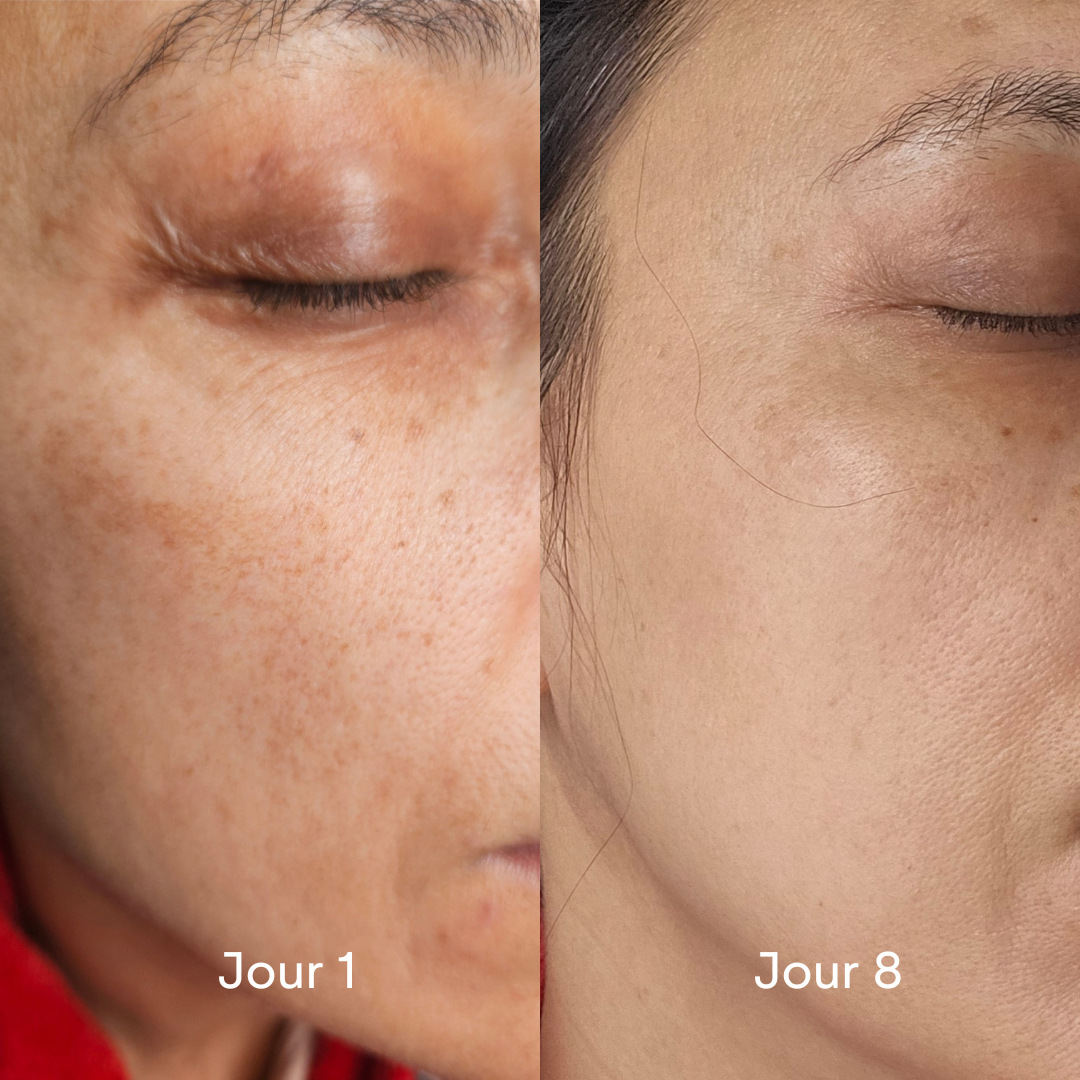 Routine regain de jeunesse